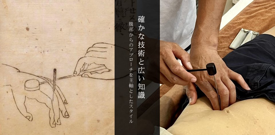 無分流打鍼術